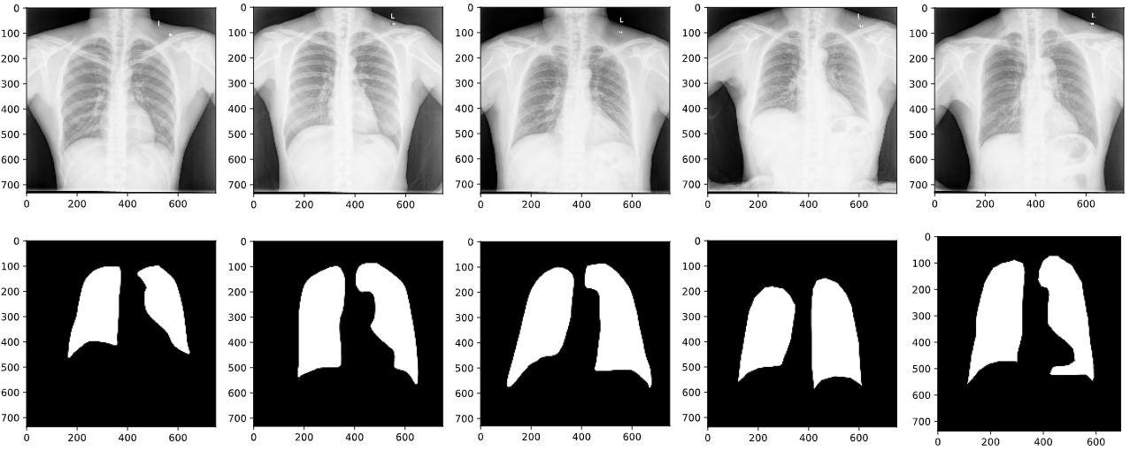 Lung and its mask visualization
